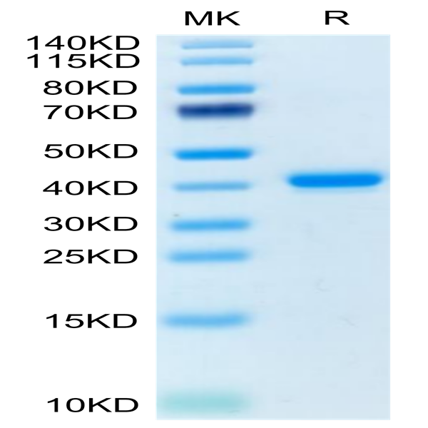 Human TNFRSF12A/TWEAKR Protein (TNF-HM20A)