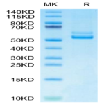 Human TNFSF12/TWEAK Protein (TNF-HM212)