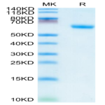 Human TNFR1/CD120a/TNFRSF1A Protein (TNF-HM2R1)