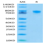 Human TNFR2/CD120b/TNFRSF1B Protein (TNF-HM3R2)