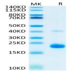 Human TNF alpha Protein (TNF-HM40A)