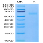 Mouse TNFRSF19 Protein (TNF-MM119)