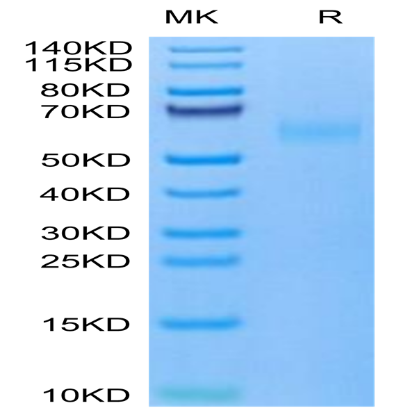 Mouse TNFRSF19 Protein (TNF-MM119)