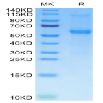Mouse TNFRSF11B Protein (TNF-MM11B)