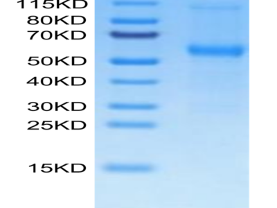 Mouse TNFRSF11B Protein (TNF-MM11B)