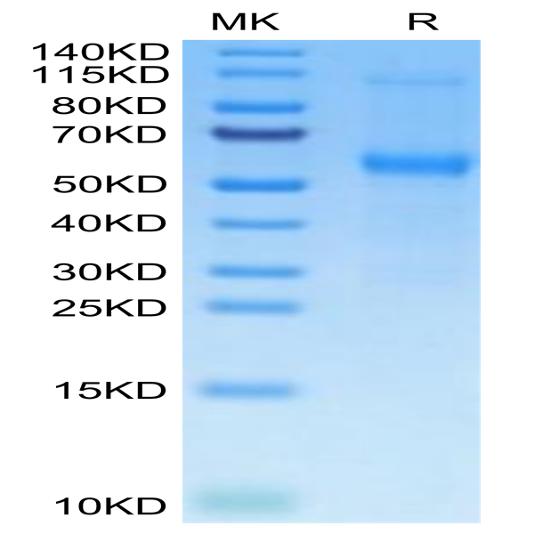 Mouse TNFRSF11B Protein (TNF-MM11B) Mouse TNFRSF11B Protein (TNF-MM11B)