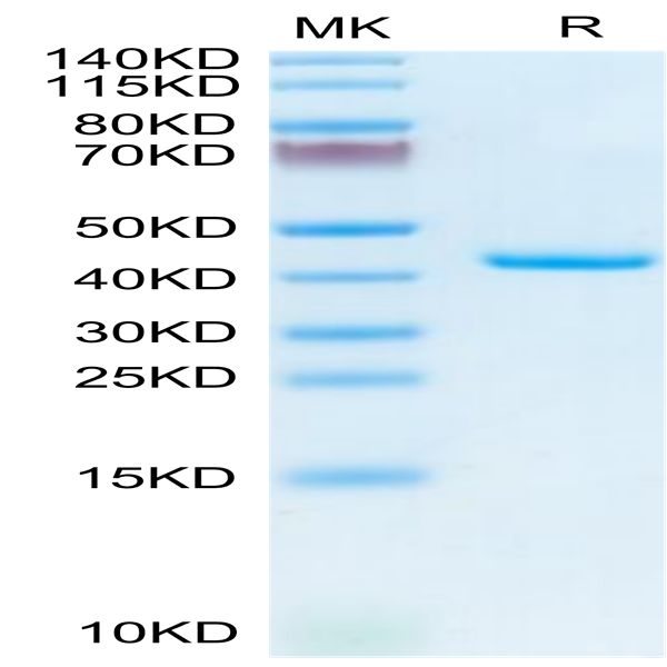 Mouse TNFRSF12A/TWEAKR Protein (TNF-MM20A)