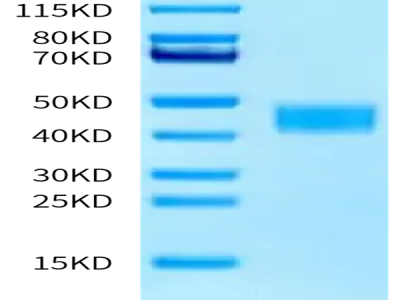 Mouse TNFSF12/TWEAK Protein (TNF-MM612)