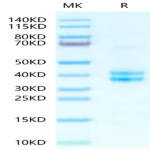 Human tPA Protein (TPA-HM10A)