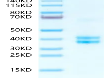 Human tPA Protein (TPA-HM10A)