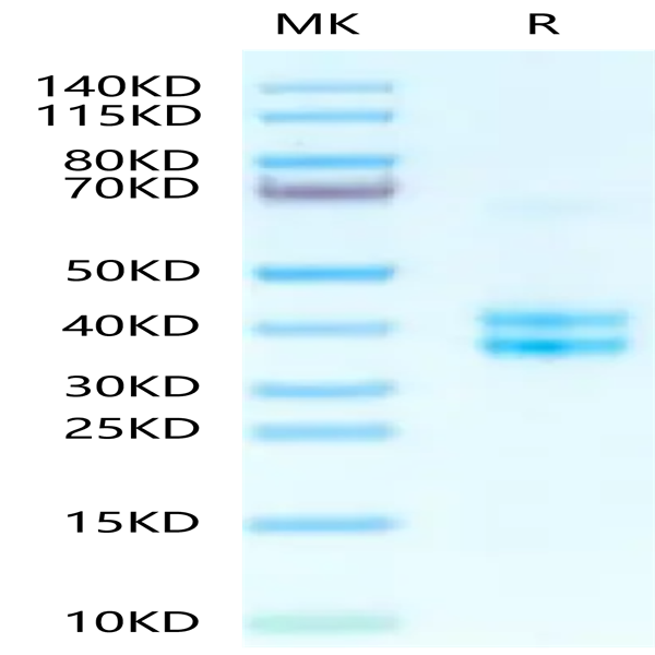 Human tPA Protein (TPA-HM10A) Human tPA Protein (TPA-HM10A)