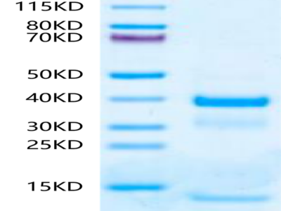 Mouse tPA Protein (TPA-MM101)