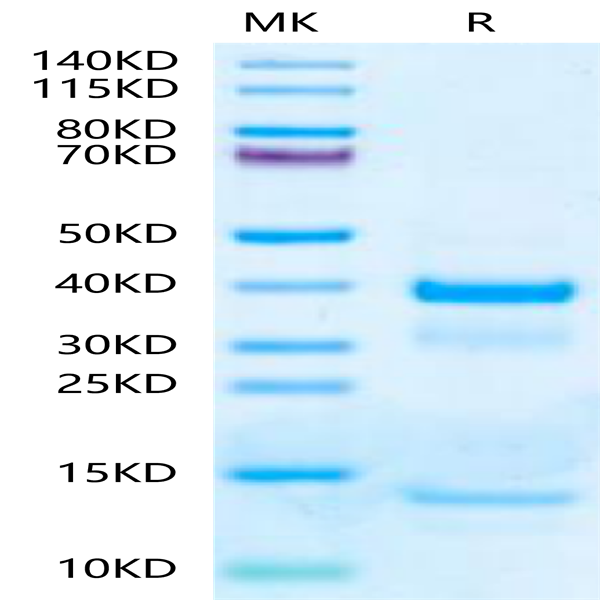 Mouse tPA Protein (TPA-MM101) Mouse tPA Protein (TPA-MM101)