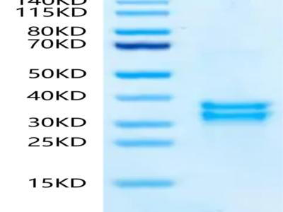 Mouse tPA Protein (TPA-MM201)