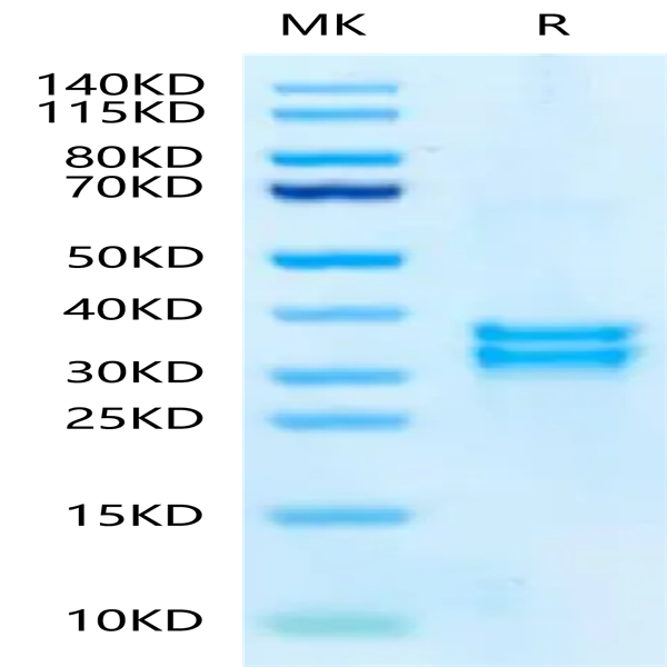 Mouse tPA Protein (TPA-MM201) Mouse tPA Protein (TPA-MM201)