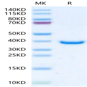 Human TPM1 Protein (TPM-HE101)