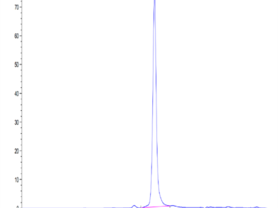 Human Thyroid Peroxidase Protein (TPO-HM101)