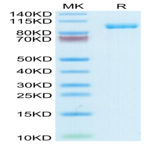 Human Thyroid Peroxidase Protein (TPO-HM101)