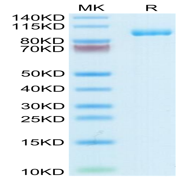 Human Thyroid Peroxidase Protein (TPO-HM101)
