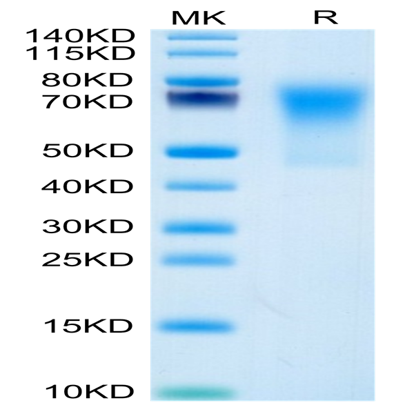 Human DcR1/TRAILR3 Protein (TRA-HM103)