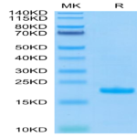 Human TRAIL/TNFRSF10 Protein (TRL-HE001)