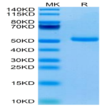 Human TRAIL R1/DR4/TNFRSF10A Protein (TRL-HM2R1)