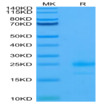 Human TRAIL R1/DR4/TNFRSF10A Protein (TRL-HM4R1)