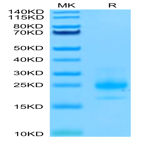 Biotinylated Human TRAIL R1/DR4/TNFRSF10A Protein (TRL-HM4R1B)