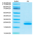 Human TRAIL R2/DR5/TNFRSF10B Protein (TRL-HM4R2)