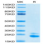 Biotinylated Human TRAIL R2/DR5/TNFRSF10B Protein (TRL-HM4R2B)