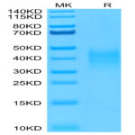 Human TRAIL R4/TNFRSF10D Protein (TRL-HM4R4)