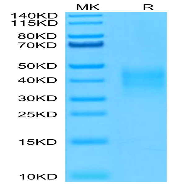 Human TRAIL R4/TNFRSF10D Protein (TRL-HM4R4)