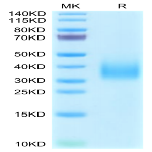 Cynomolgus TREM2 Protein (TRM-CM401)