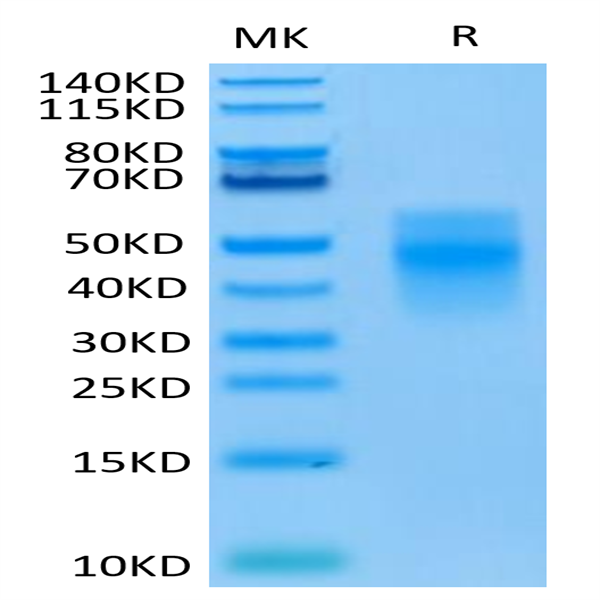 Human TREM1 Protein (TRM-HM101)