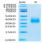 Biotinylated Human TREM2 Protein (TRM-HM401B)