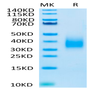 Biotinylated Human TREM2 Protein (TRM-HM401B)