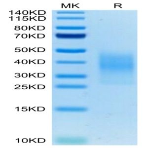 Mouse TREM2 Protein (TRM-MM101)