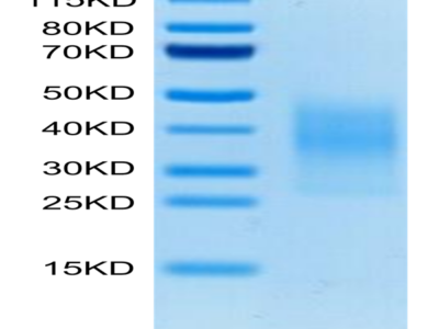 Mouse TREM2 Protein (TRM-MM101)