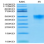 Human TROP-2/TACSTD2 Protein (TRP-HM121)