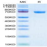 Human TROP-2/TACSTD2 Protein (TRP-HM221)