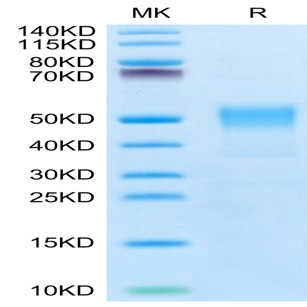 Biotinylated Human TROP-2/TACSTD2 Protein (TRP-HM421B)