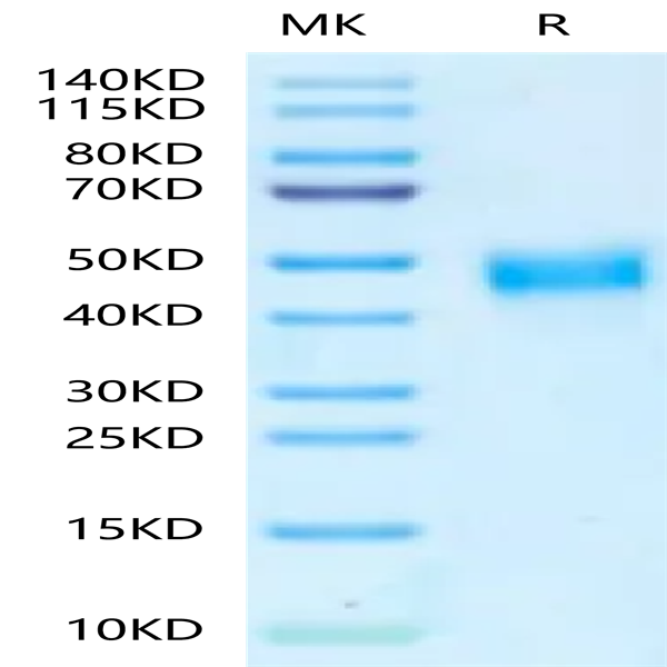 Mouse TROP-2/TACSTD2 Protein (TRP-MM121)
