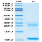 Biotinylated Human TSLP Protein (TSP-HM401B)