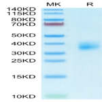 Mouse TSLPR Protein (TSP-MM10R)