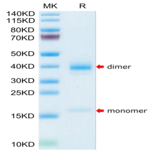 Human Transthyretin/Prealbumin Protein (TSR-HM101)