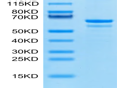 Human Tubby Protein (TUB-HE101)