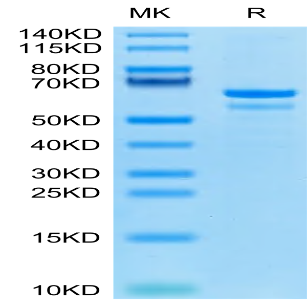 Human Tubby Protein (TUB-HE101) Human Tubby Protein (TUB-HE101)