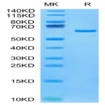 Human Tulp1 Protein (TUP-HE101)