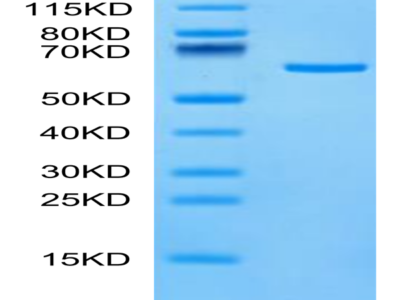 Human Tulp1 Protein (TUP-HE101)