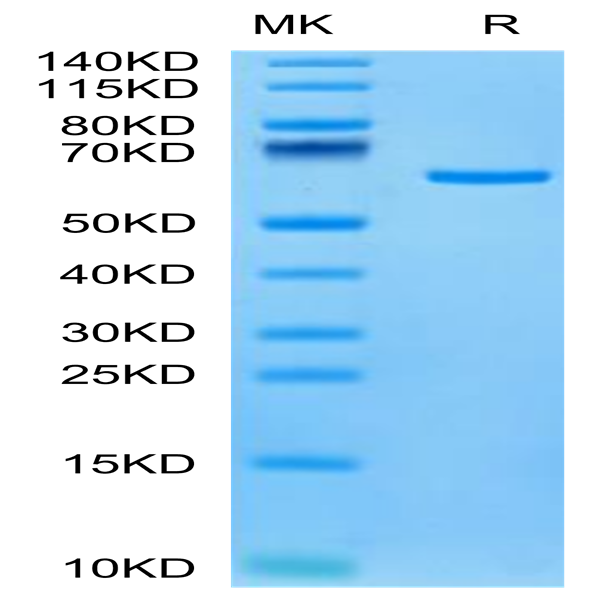 Human Tulp1 Protein (TUP-HE101) Human Tulp1 Protein (TUP-HE101)